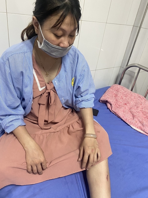 Công nhân Diệu chỉ bị xước xát nhẹ, không ảnh hưởng đến sức khỏe
