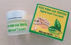 troi noi nhieu san pham lam dep khong ro nguon goc