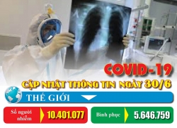can tiep tuc sua dieu kien huong ho tro tu goi 62000 ty cho doanh nghiep lao dong