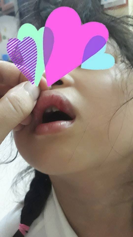 Có hay không việc học sinh bị cô giáo bạo hành vì làm sai bài toán? co hay khong viec hoc sinh bi co giao bao hanh vi lam sai bai toan