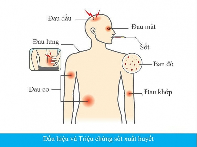 dau hieu nhan biet mac sot xuat huyet va cach phong tranh