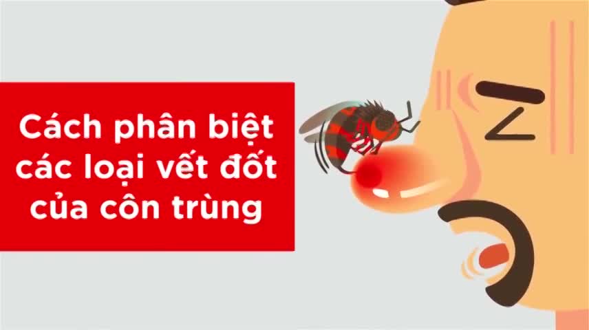 Nhận dạng các vết cắn của côn trùng để xử lý đúng cách