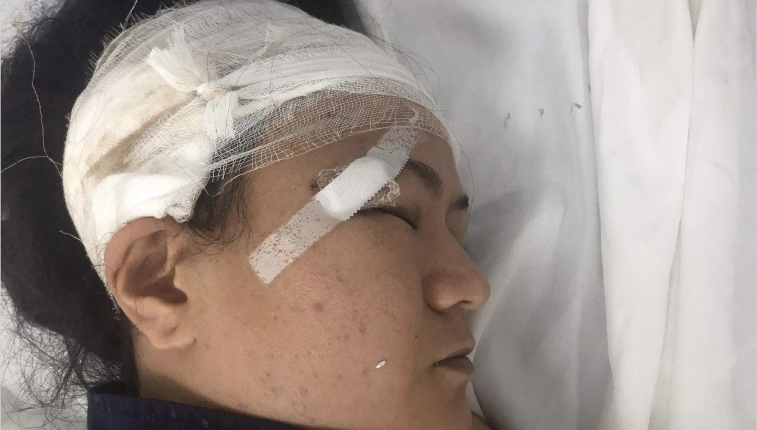 Nữ lao công bị ô tô tông trọng thương rồi bỏ chạy